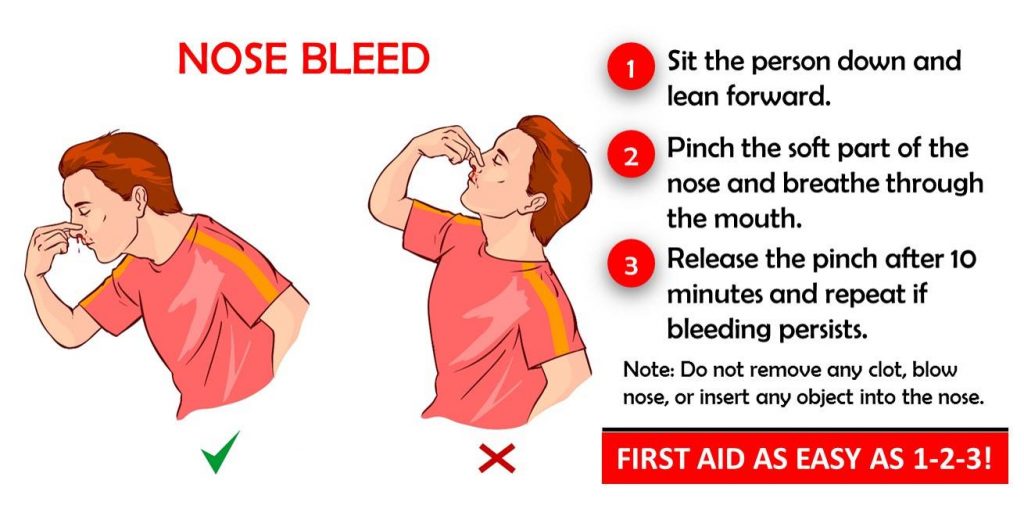 how-to-treat-and-prevent-nosebleeds-shoensafety-llc