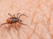 Deer tick on human skin